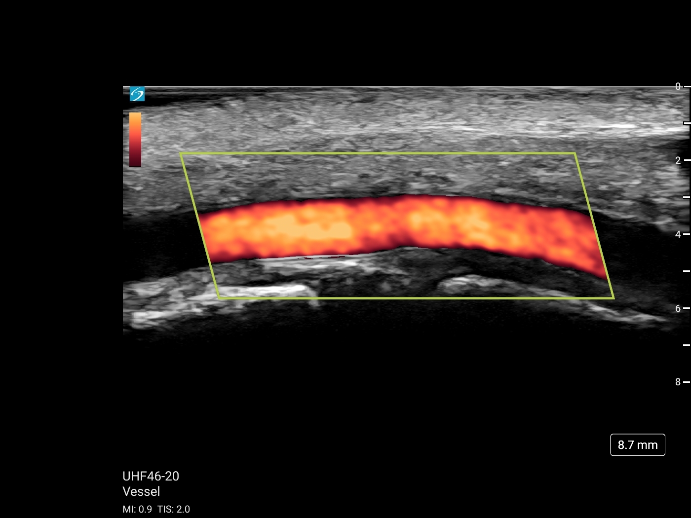 Clinical Images & Videos | FUJIFILM Sonosite